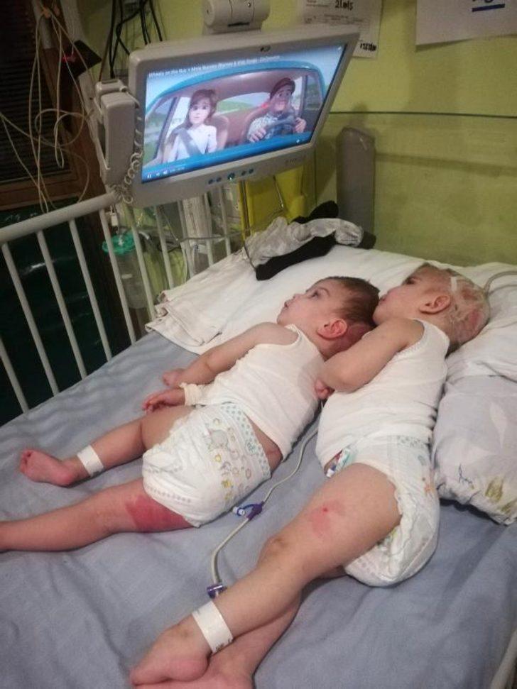 Güzel haberi Cumhurbaşkanı Erdoğan vermişti! İşte ikizlerin son halleri G5