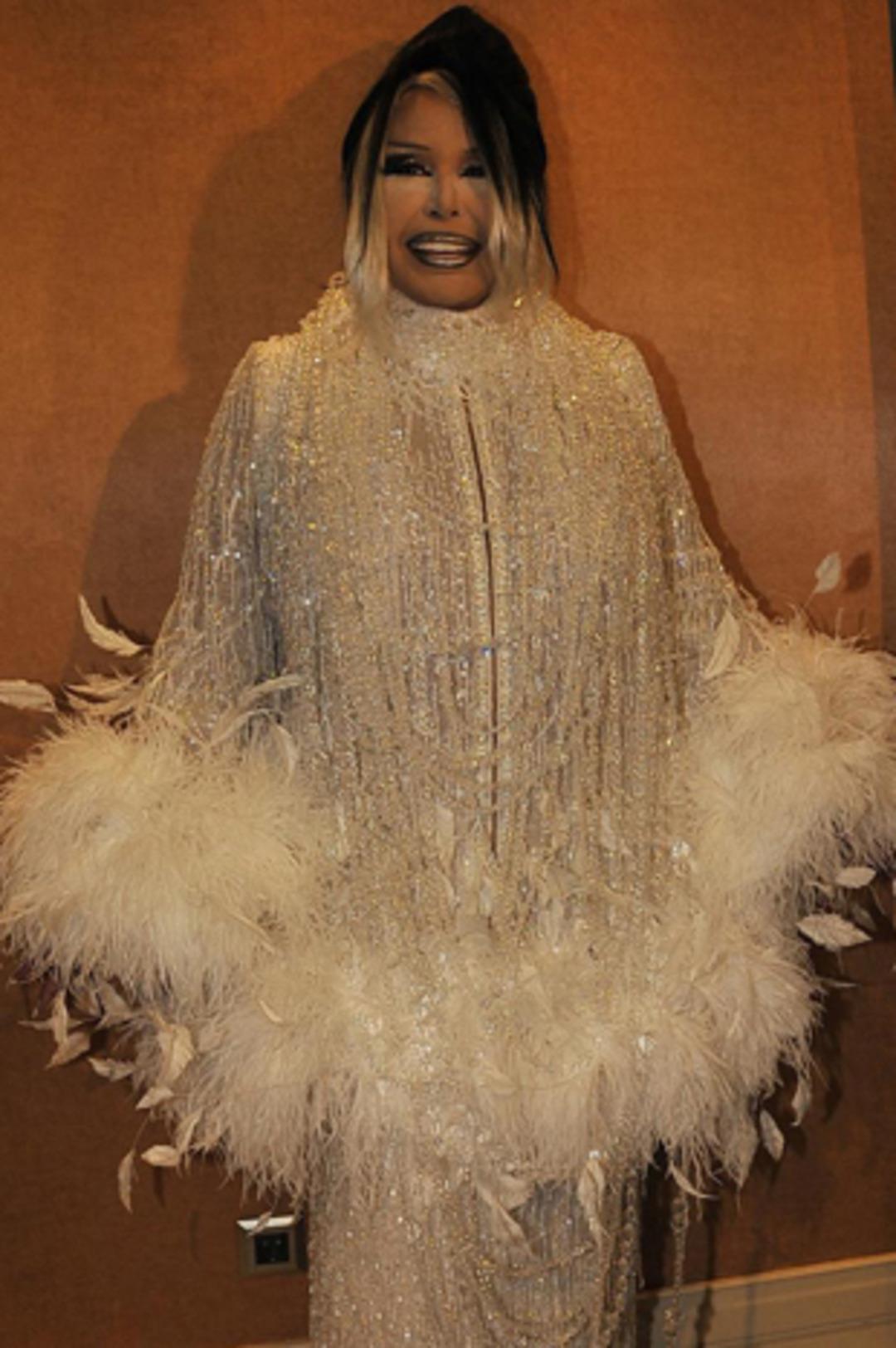 B&uuml;lent Ersoy'a nazar değdi