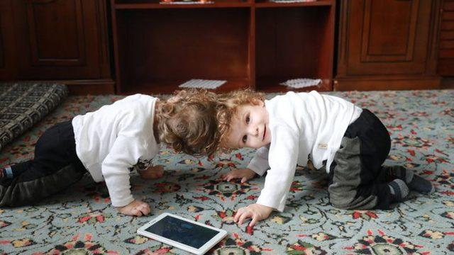 Cumhurbaşkanı Erdoğan, siyam ikizlerinin ailesiyle görüştü