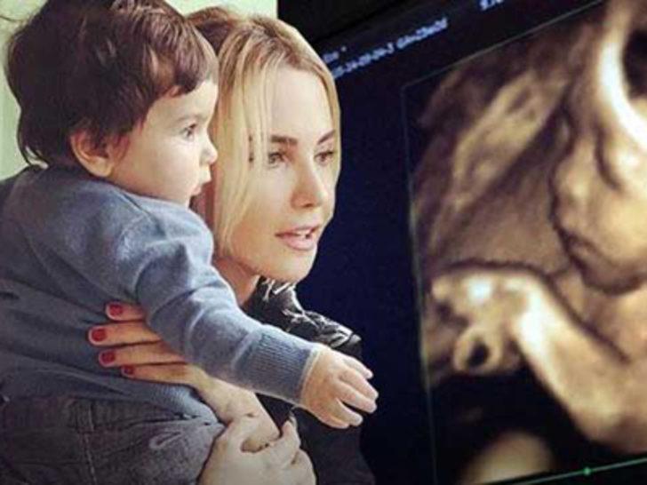 Ece Erken oğlu Eymen'in ultrason fotoğrafını paylaşınca olay oldu G1