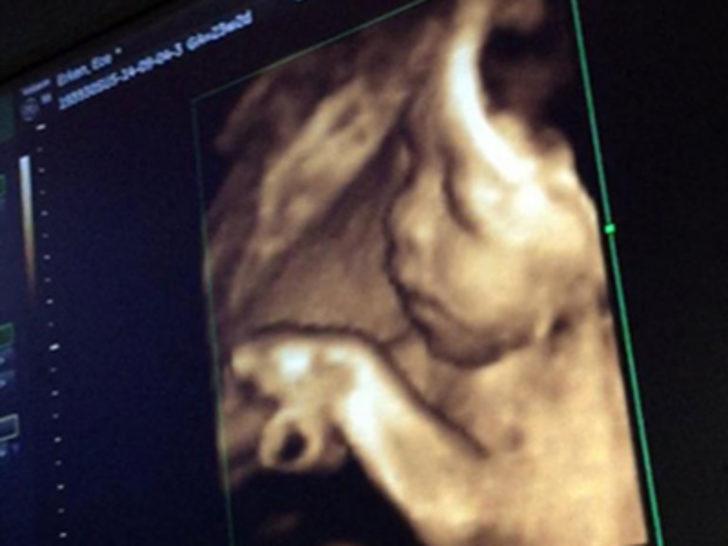 Ece Erken oğlu Eymen'in ultrason fotoğrafını paylaşınca olay oldu G2