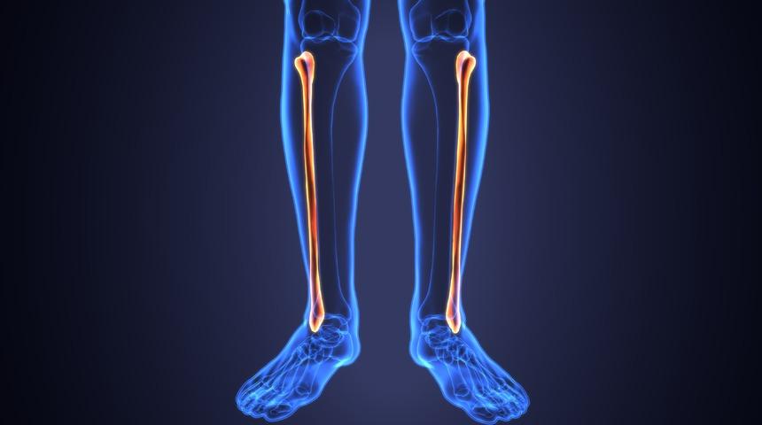 Tibia ve fibula kemiği nedir? Kaval kemiği (Tibia kemiği) nerededir? Kaval kemiği (Tibia kemiği ) kırılması nasıl tedavi edilir?