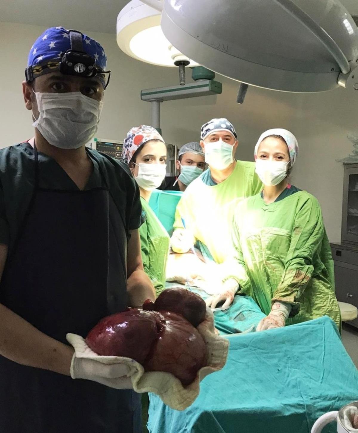 Karnından 5 kilo ağırlığında t&uuml;m&ouml;r &ccedil;ıkarıldı