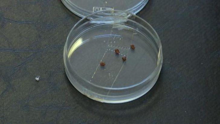 İstanbullular dikkat! Koronavirüsten sonra ‘Lyme’ tehlikesi G3