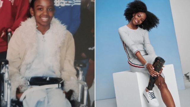 Çocukken sarhoş sürücünün çarpmasıyla bir bacağını kaybeden kadın Vogue modeli oldu