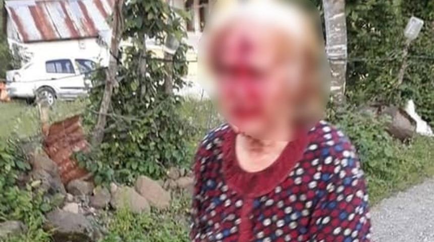 Tartıştığı yengesini baltayla başından yaraladı