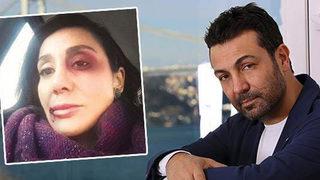 Saruhan Hünel'in 17 yıl hapsi isteniyor