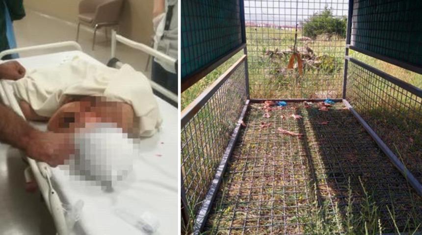 Kayseri'de yırtıcı hayvanın saldırdığı 2 yaşındaki &ccedil;ocuk yaralandı