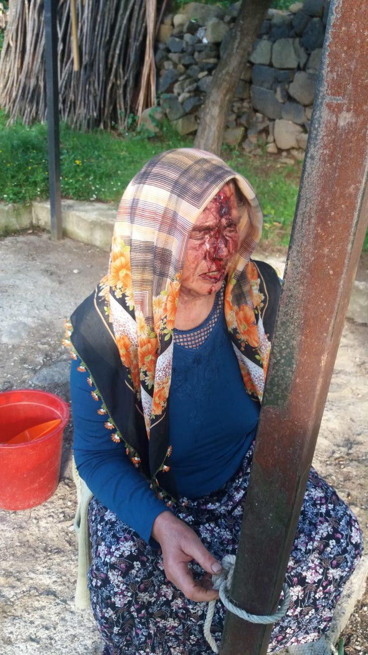 Kayınbiraderinin baltayla yaraladığı kadın konuştu G3