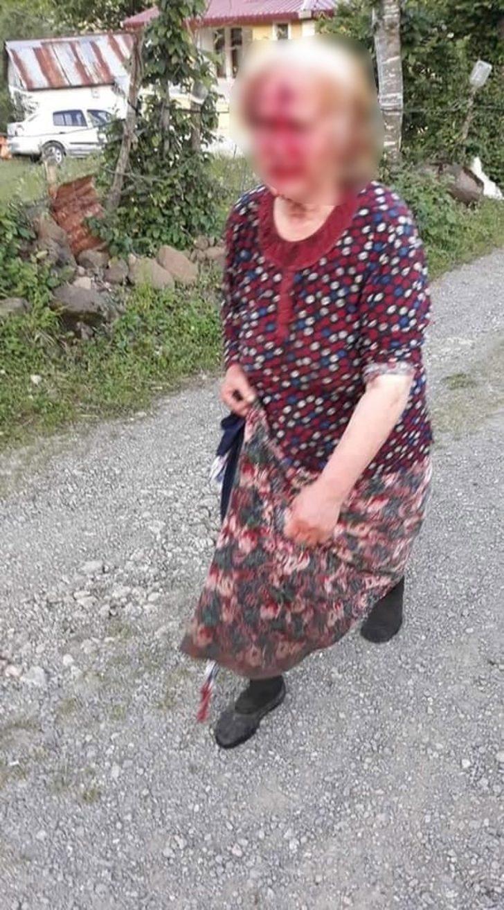 Kayınbiraderinin baltayla yaraladığı kadın konuştu G4