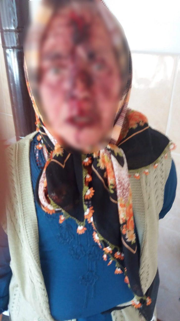 Kayınbiraderinin baltayla yaraladığı kadın konuştu G5