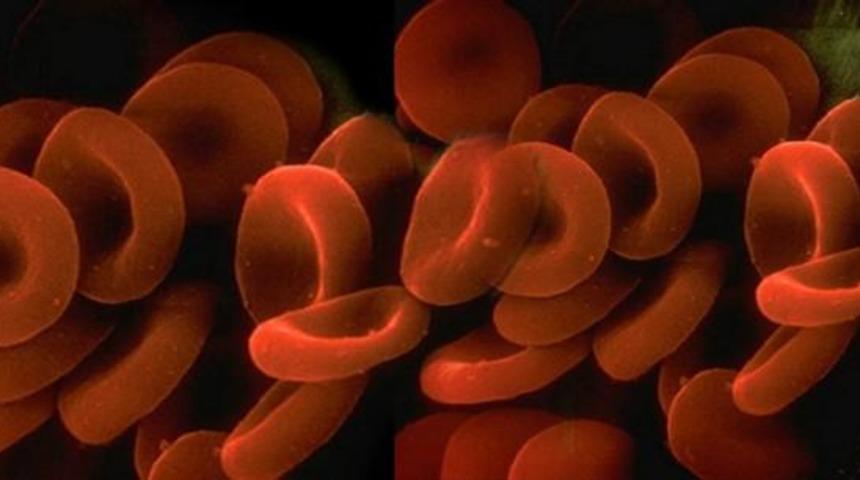 Uzmanlardan akdeniz anemisi uyarısı