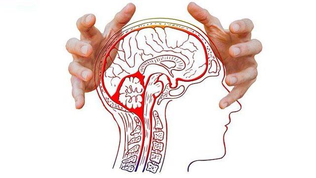 Beyin Kanaması : Nedenleri, Belirtileri, Tedavisi