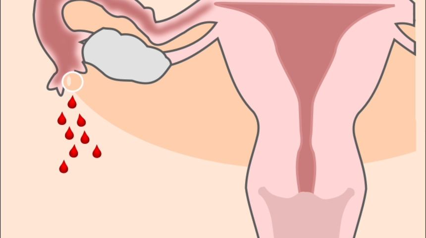 Jinekolojik Check-Up nedir? Neleri kapsar?