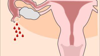 Jinekolojik Check-Up nedir? Neleri kapsar?