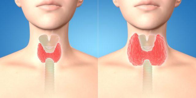 tiroid bezleri