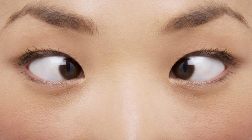 Şaşılık : Neden Olur, Nasıl Geçer?