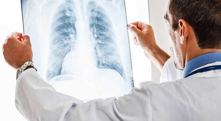 Araştırma sonucu kanıtladı: Düzenli diş fırçalama zatürreye karşı koruyor!  G2