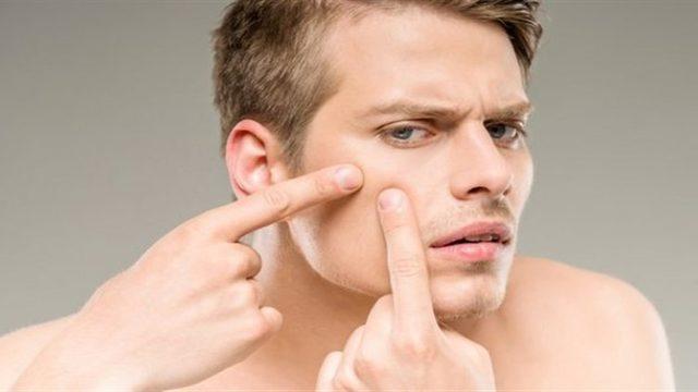 En Etkili Sivilce Kremi Markaları, Sivilce Lekelerine Çözüm