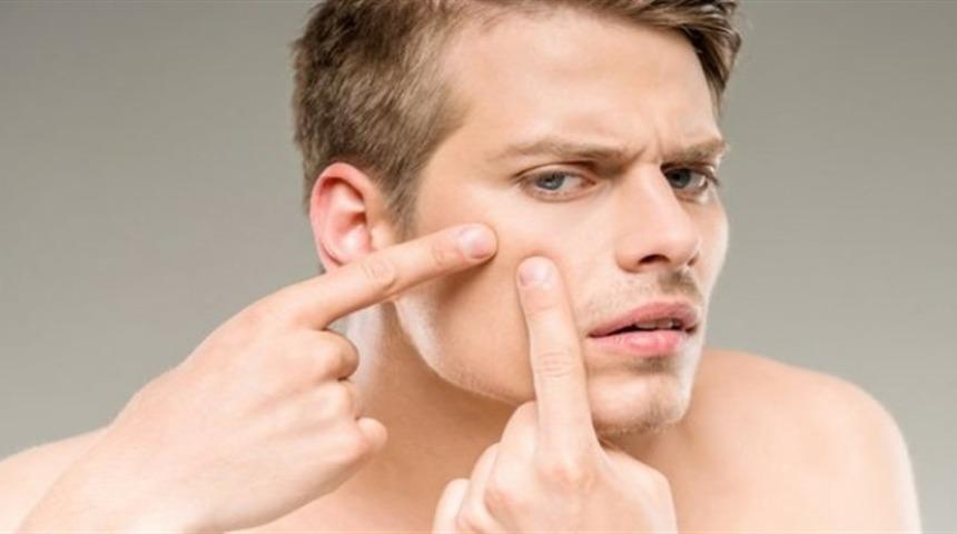 En Etkili Sivilce Kremi Markaları, Sivilce Lekelerine Çözüm