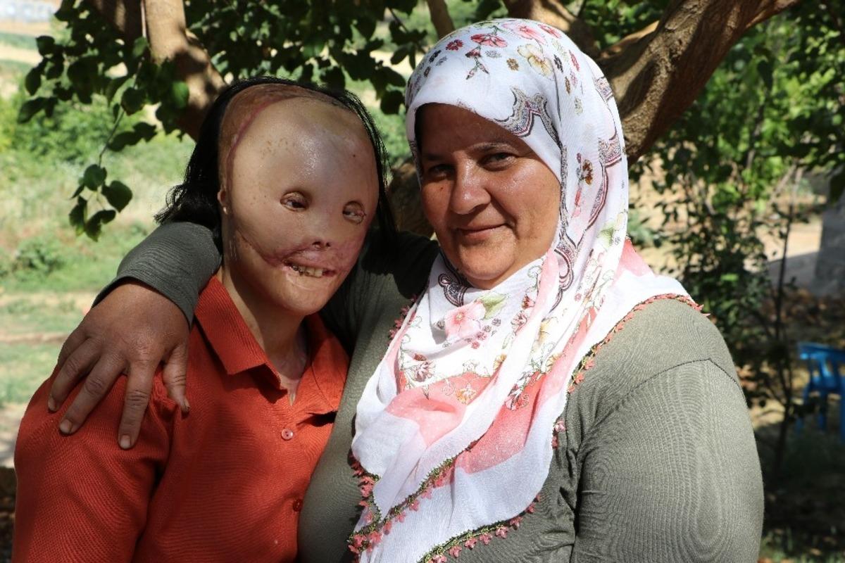 Akdeniz &Uuml;niversitesi Layla&rsquo;nın y&uuml;z&uuml;n&uuml; g&uuml;ld&uuml;rd&uuml;