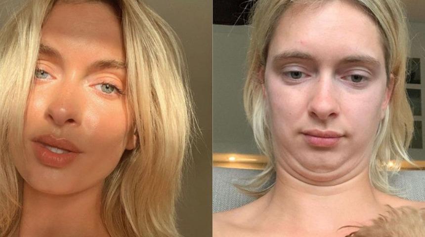 Sosyal medyanın gerçek hayat olmadığını kanıtlayan Instagram fenomeni