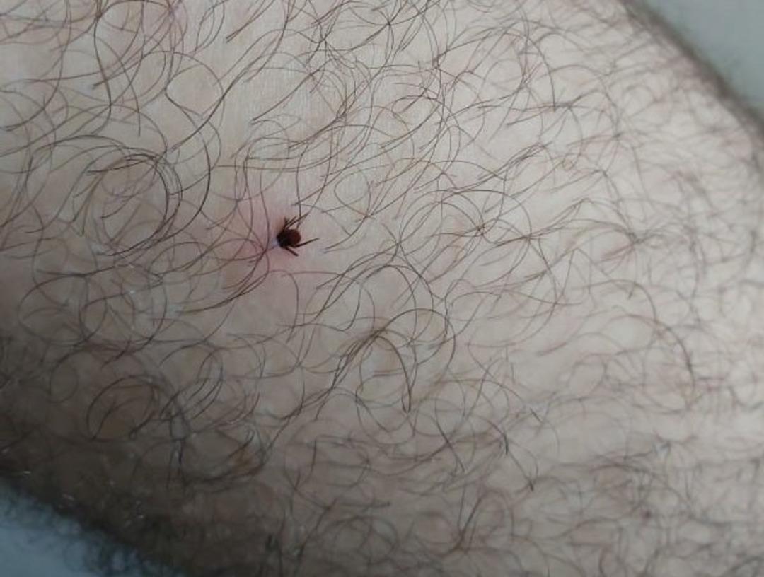 Ordu’da kene vakası