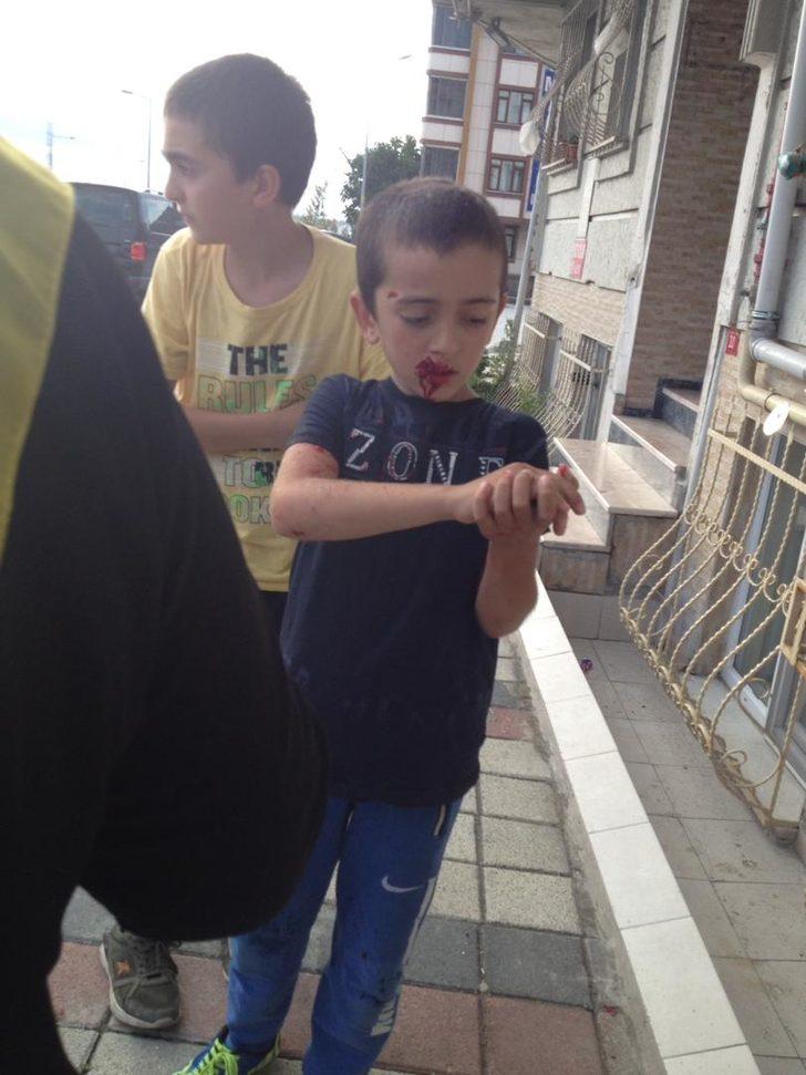 Sultangazi'de küçük çocuk köpek saldırısı sorucu yaralandı G3