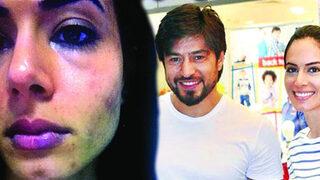 İbrahim Toraman eşini böyle dövmüş