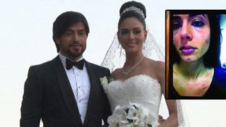 İbrahim Toraman'ın eşi dayak yediğini itiraf etti