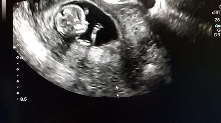 En detaylı ultrason terimleri rehberi