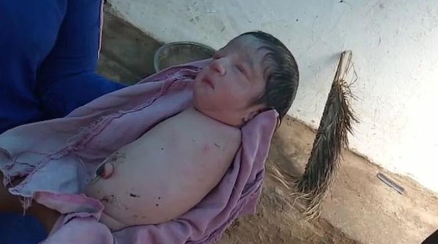 Hindistan&rsquo;da kolları ve bacakları olmayan bebek şaşırttı