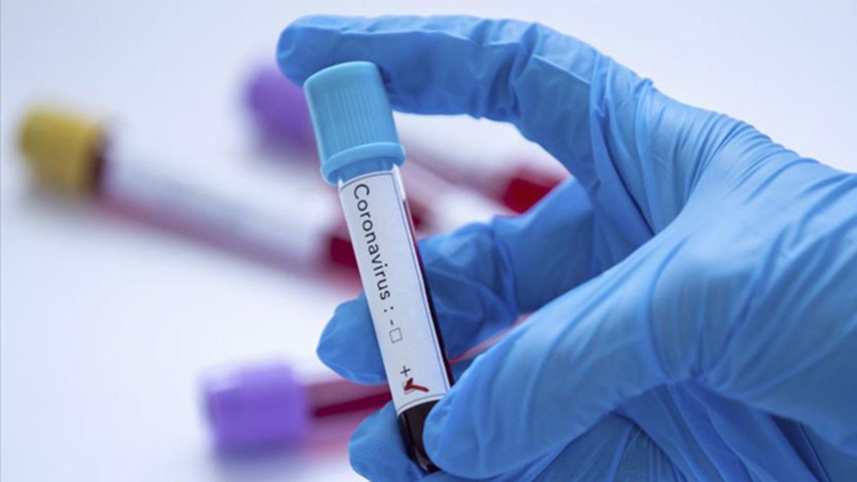 Meksika ekibi Cruz Azul'de 22 kişi koronavir&uuml;se yakalandı