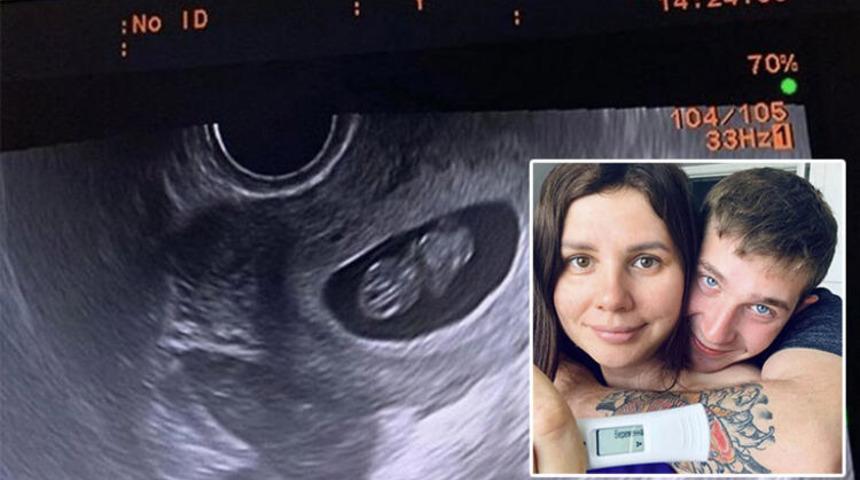 Üvey oğlundan hamile kalan kadından skandal paylaşım!