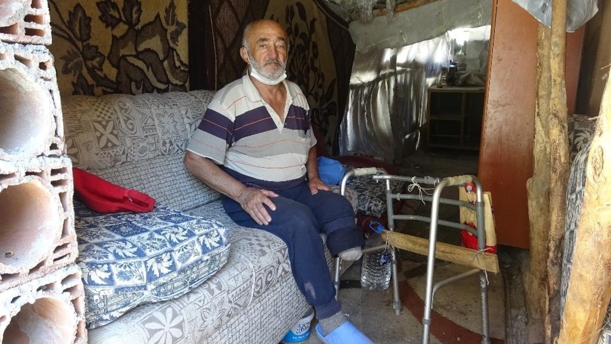 Tek bacağı ile yaşam savaşı veriyor