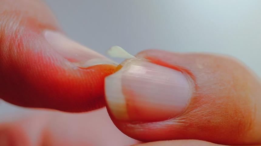 Tırnaklarınız devamlı kırılıyorsa bunu uygulamalısınız! Zeytinyağı, limon...