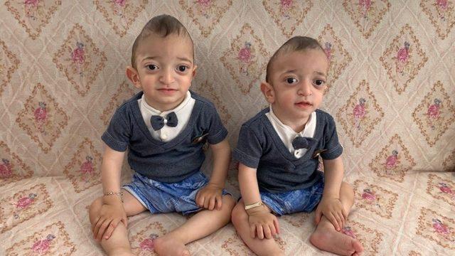 Hasta ikiz çocuklar yardım bekliyor