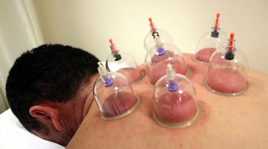 Hacamat günleri geldi... 2020 Aralık ayı hacamat takvimi - Aralık ayında hangi günler hacamat yapılır? 