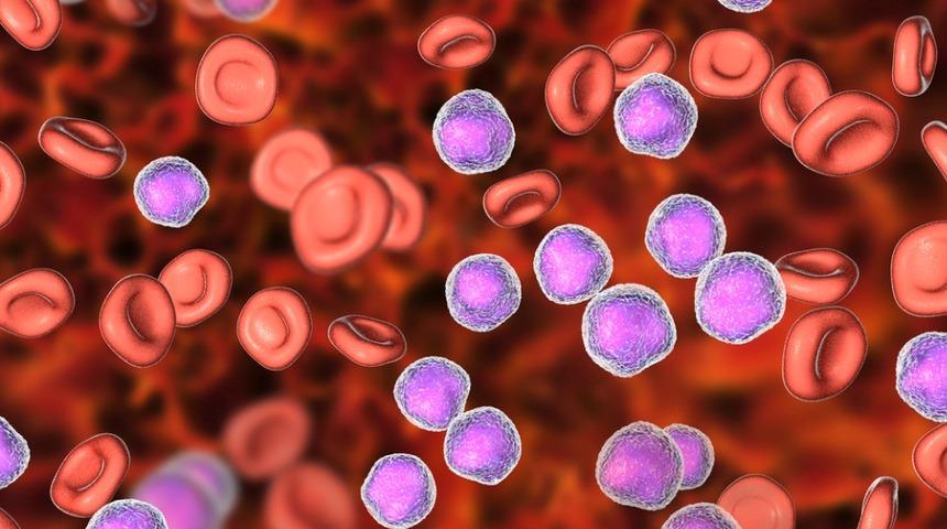 Bu belirtiler lenfoma habercisi olabilir! Vakit kaybetmeden...