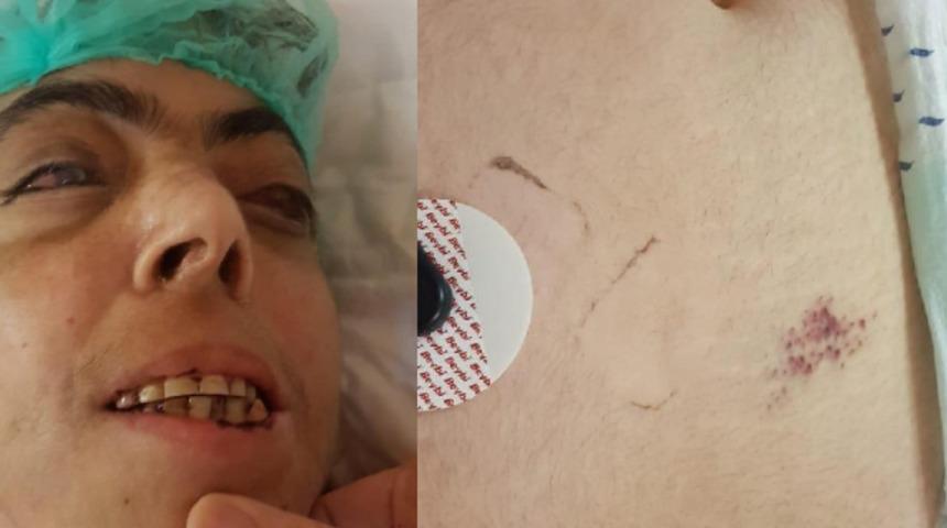 &Ouml;zel bakım merkezinde işkence! G&ouml;zlerini oymuşlar