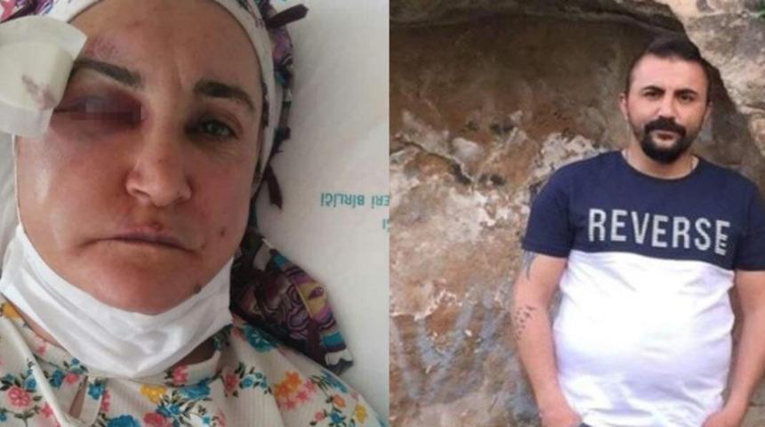 Sokak ortasında kadınlara saldıran şahıs tutuklandı