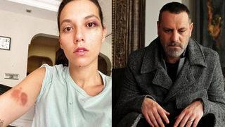 Deniz Bulutsuz ve Ozan Güven arasındaki davada ilk duruşma 21 Ocak’ta