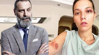 Senaristlerden Ozan Güven bildirisi: Tüm yapımcı ve kanallar tavır alsın