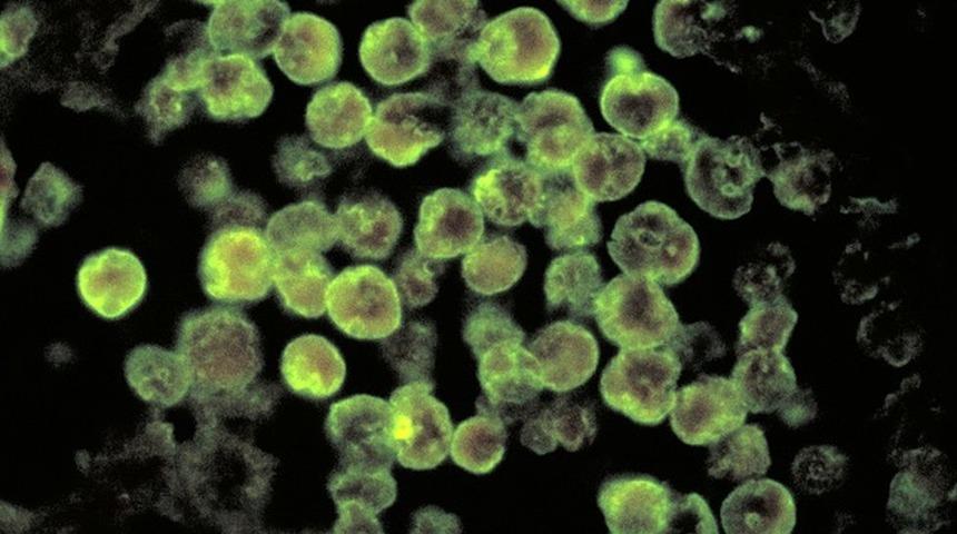 Naegleria fowleri: ABD'de 'beyin yiyen amip vakası görüldü'