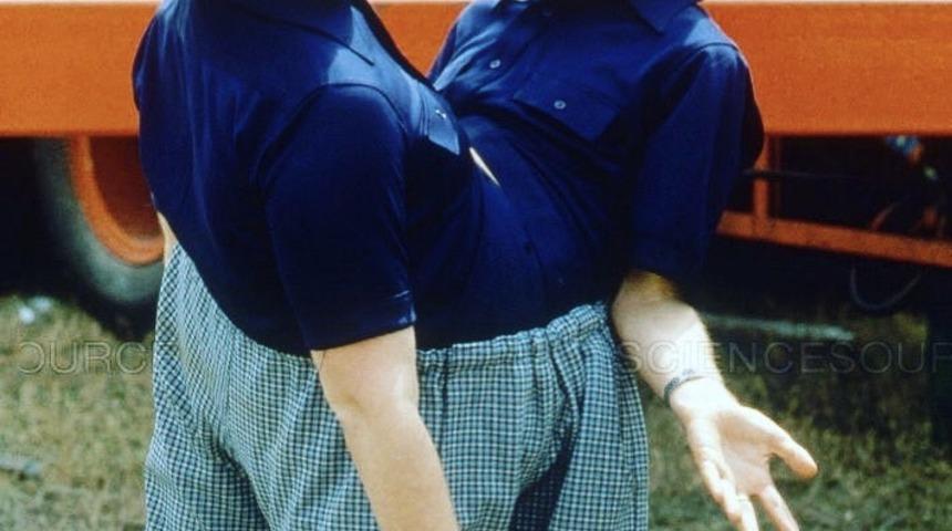 Dünyanın en uzun süre hayatta kalan yapışık ikizleri 68 yaşında öldü