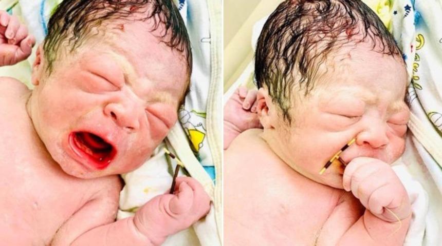 Elinde tuttuğu spiralle dünyaya gelen bebek