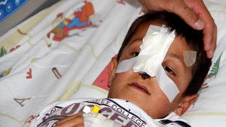 Ağrı'da küçük çocuk dehşeti yaşadı! Köpeklerin saldırısında uğradı