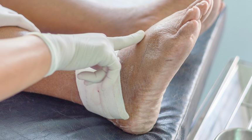 Gut hastalığı : Nedenleri, belirtileri, tedavisi