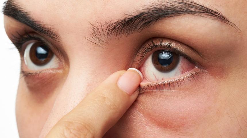 Göz Tansiyonu : Nedenleri, belirtileri, tedavisi