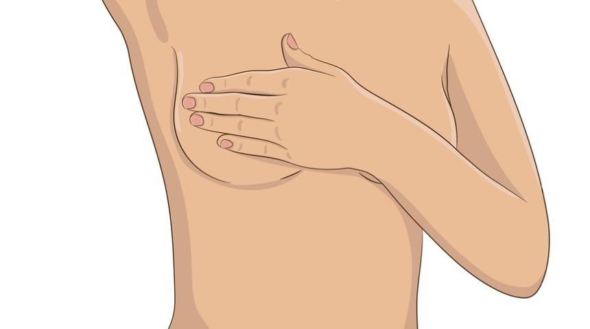 Göğüs Kanseri : Nedenleri, belirtileri, tedavisi